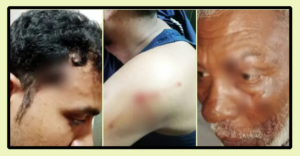 ঈশ্বরদীতে টহল পুলিশের ওপর গুলি: ফাঁড়ি ইনচার্জসহ আহত ৫